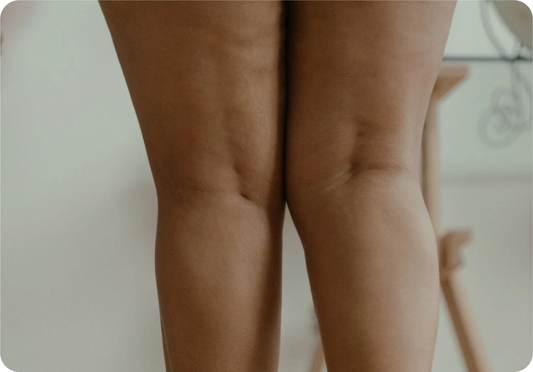 gua sha reduce leg fat